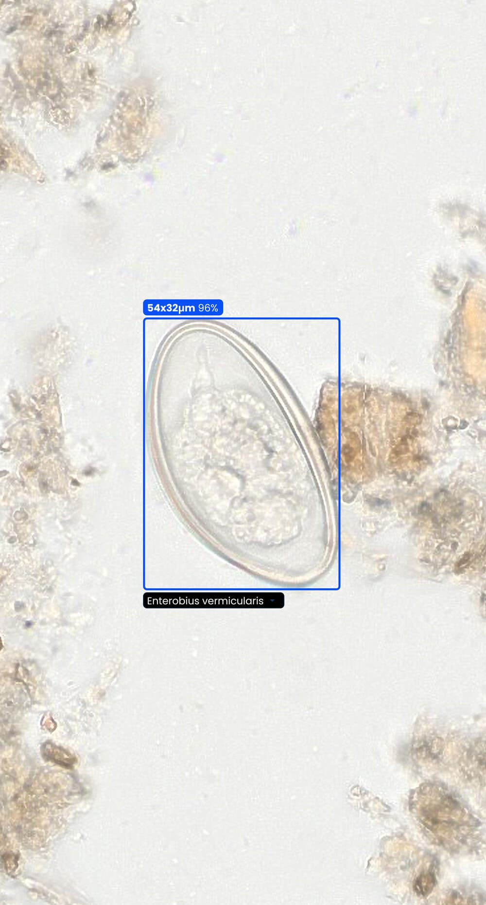 Microscope specimen preview with parasite detection overlay.