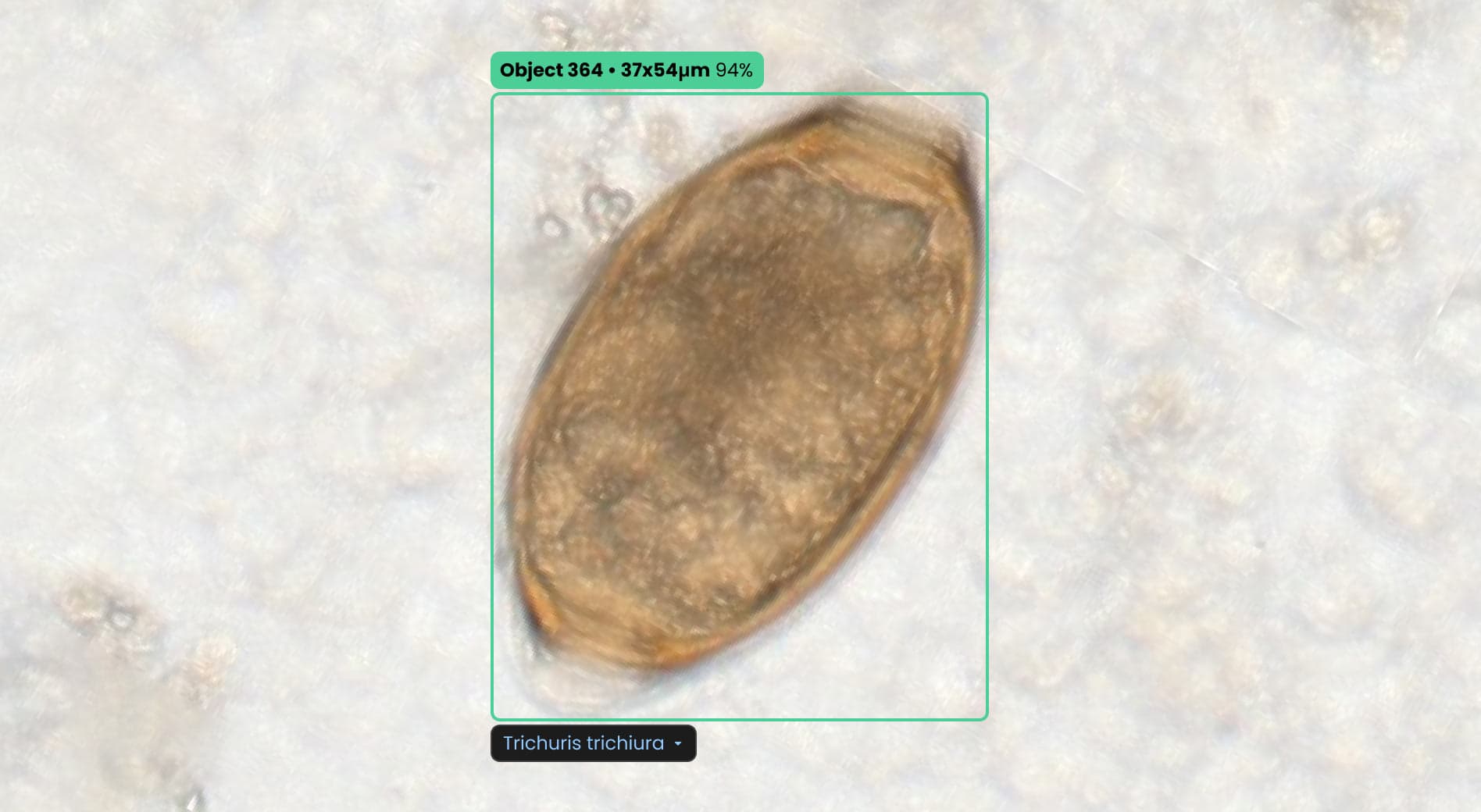 ParaScout AI microscopic image showing a Trichuris trichiura (Whipworm) egg with bipolar plugs, AI detection box, automated measurement (37x54 µm), and 90% confidence score