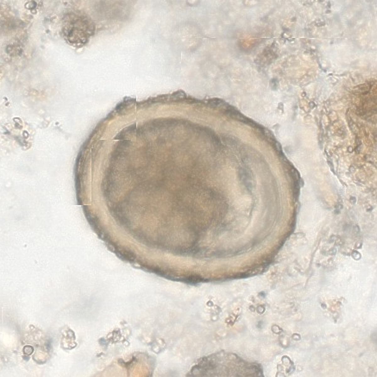 ParaScout AI microscopic image showing an Ascaris lumbricoides egg with AI detection box, displaying the automated measurement (65x45 µm) and 92% confidence score.