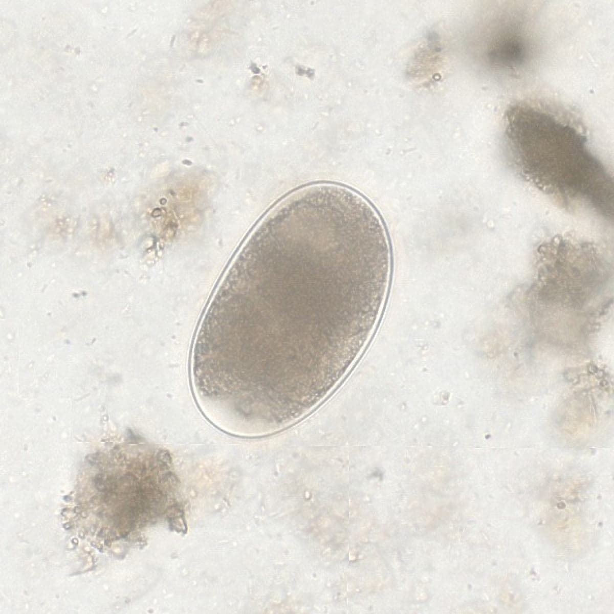ParaScout AI microscopic image showing a thin-shelled Hookworm egg with developing embryo, AI detection box, automated measurement (55x35 µm), and 95% confidence score.