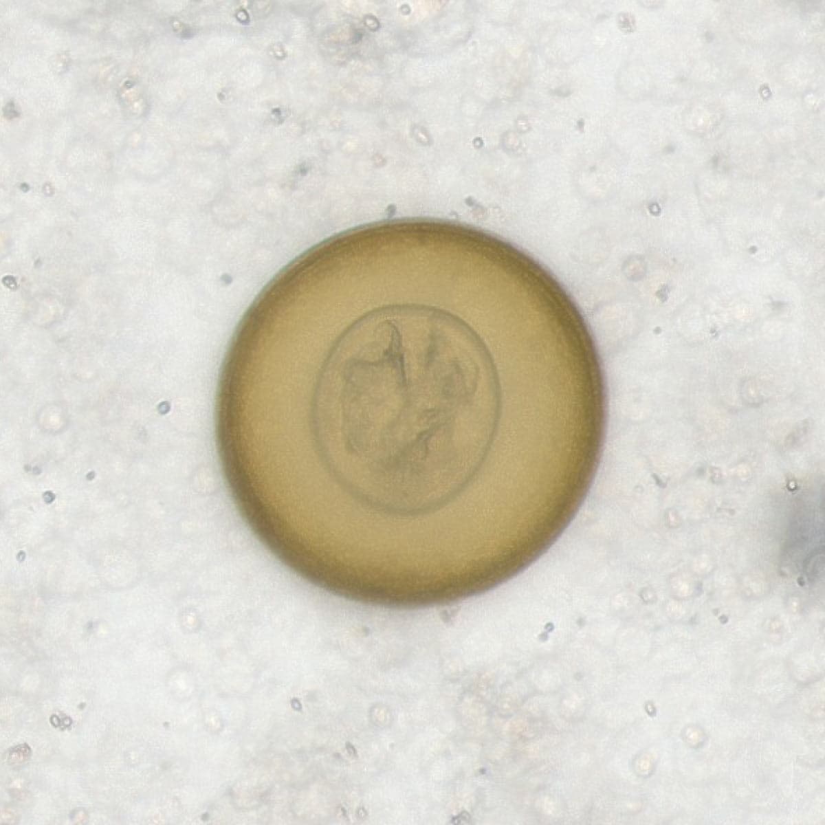 ParaScout AI microscopic image showing a large, spherical Hymenolepis diminuta egg with internal oncosphere, AI detection box, automated measurement (71x65 µm), and 95% confidence score.