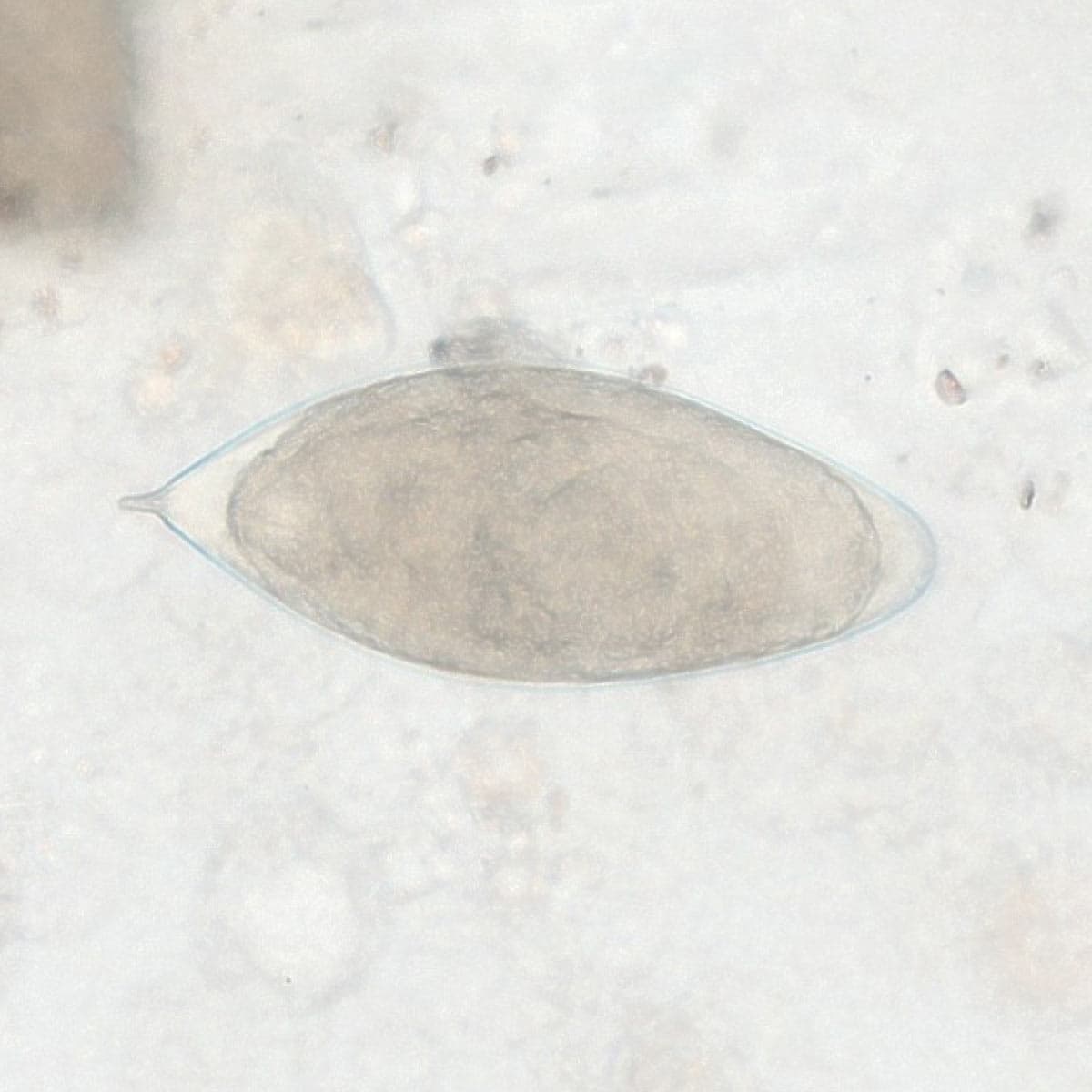 ParaScout AI microscopic image showing a Schistosoma haematobium egg with characteristic terminal spine, AI detection box, automated measurement (142x54 µm), and 94% confidence score.